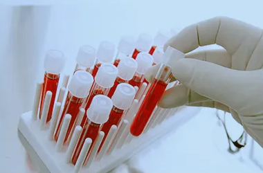 如何在香港找到验血机构？哪些血液检测机构的命中率高？