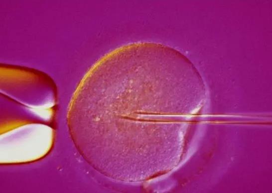 廊坊供卵助孕服务：如果你不知道什么是体外受精，请继续阅读，可以进行体外受精的医院