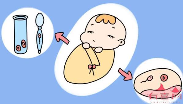 株洲48岁a卵b怀：试管婴儿可以实现同性生育吗？